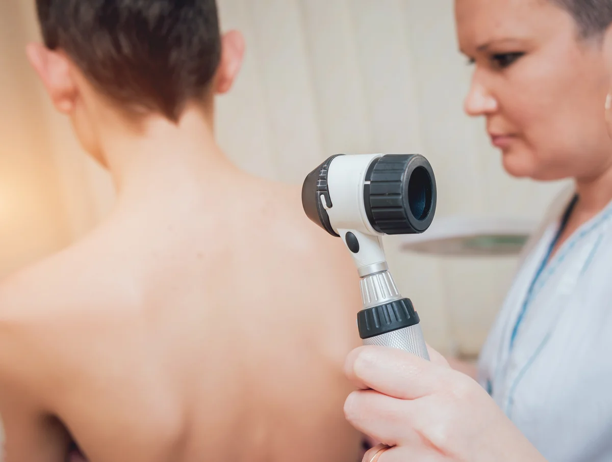 Figure 1: Dermatological examination of halo nevi verifies symmetrical depigmentation and benign architecture.