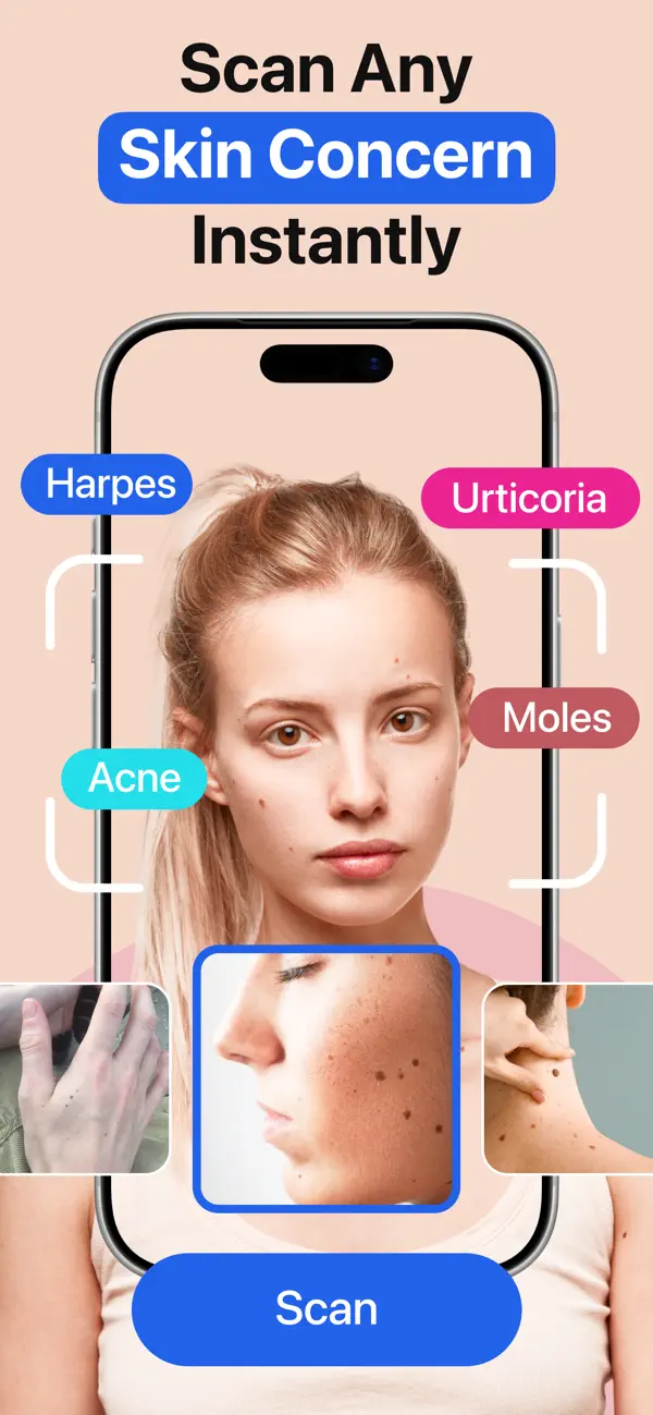 Scan Skin Concerns